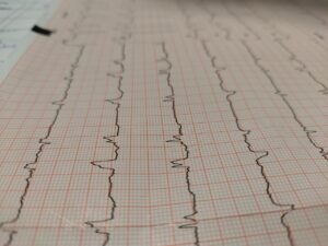 冷房病による体調不良はいつまで続くのか？